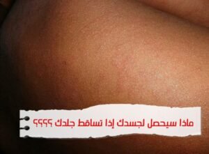 الجلد