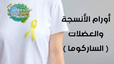 الساركوما (sarcoma ) , سرطان ساركوما , نسبة الشفاء من سرطان الساركوما , ساركوما العظام , حالات شفيت من الساركوما , الساركوما العظمية , نسبة الشفاء من الساركوما العظمية , ساركوما الرئة , نسبة الشفاء من ساركوما العظام , مرض ساركوما , الساركوما الغضروفية , ورم ساركوما , أنواع أورام الساركوما , اعراض الساركوما العظمية , ساركوما سرطان , اعراض الساركوما , نسبة الشفاء من الساركوما , سرطان ساركوما العظام , ما هو سرطان الساركوما , علاج الساركوما بالاعشاب , ساركوما الرحم , سرطان ساركوما الرئة , سرطان كابوزي , علاج الساركوما , سرطان ساركوما الرحم , سرطان ساركوما الثدي , سرطان ساركوما البطن , ساركوما إيوينغ , ساركوما عظمية , كانسر ساركوما , ورم الساركوما , ساركوما كابوزي الجلد , اعراض ساركوما العظام , ايوينغ ساركوما , مرض الساركوما العظمية , ساركوما غضروفية , سرطان الساركوما في الرئة , سرطان ساركوما كابوسي , ساركوما ايوينغ , الساركوما الرحمية , مرض ساركوما العظام , ساركوما الثدي , أورام الأنسجة والعضلات , الساكورما , هل الساركوما قاتل , نسبة الشفاء من سرطان الساركوما , نسبة الشفاء من سرطان الأنسجة الرخوة , درجات الساركوما , ما هي الأنسجة الرخوة , أنواع أورام الساركوما , الساركوما الحميدة , الساركوما الشحمية , نسبة الشفاء من سرطان الساركوما , درجات الساركوما , الساركوما الحميدة , تجربتي مع الساركوما , نسبة الشفاء من الساركوما العظمية , درجة عالية من الساركوما , العلاج المناعي , الساركوما , أنواع أورام الساركوما , شفيت من الساركوما , هل الساركوما قاتل , وصفة لعلاج السرطان نهائيا , درجات الساركوما , الساركوما الحميدة , علاج السرطان بالاعشاب مجرب , عشبة لعلاج السرطان , الطب النبوي لعلاج السرطان , هل الساركوما قاتل , علاج سرطان الساركوما بالاعشاب , الساركوما الحميدة , نسبة الشفاء من الساركوما العظمية , درجة عالية من الساركوما , أعراض الساركوما , شكل ورم الأنسجة الرخوة , سرطان الساركوما النادر , هل الساركوما قاتل , نسبة الشفاء من سرطان الساركوما , درجات الساركوما , سرطان الساركوما ويكيبيديا , تجربتي مع الساركوما , الساركوما الحميدة , أنواع أورام الساركوما , علاج الساركوما , العلاج المستهدف , العلاج الكيمياوية , المعالجة الإشعاعية , الأعراض والعلامات السريرية , التعرض للفيروسات , التعرُّض لمواد كيميائية , التورم المزمن , العلاج الإشعاعي , المتلازمات الموروثة , الأسباب ومؤشرات الخطر التى تساهم فى حدوث الساركوما ؟ , يعنى ايه سرطان الأنسجة الرخوية( الساركوما) ؟ , الساركوما , أورام الأنسجة والعضلات (الساركوما) , سرطان الساركوما,الساركوما العظمية,ساركوما,مرض سرطان الساركوما,علاج سرطان الساركوما,علاج الساراكوما,سرطان العظام الساركوما,سرطان الساراكوما,سرطان ساركوما,مرض الساركويد,علاج سرطان الساركوما بالاعشاب,الساركويد المغرب,ما هي ساركوما العظام وطريقة تشخيصه وعلاجه,ساراكوما,السفارة,مجلس الشعب,جمال,الميلانوما,اليوم,السوري,السيسي,السويس,جلسة مجلس الشعب,السورية,السرطان,الشامات,الزمالك,الانسان,المعارضة,جمال حمزة,مصر اليوم,أحمد سالم,البرلمان , الأورام الليفية,أعراض أورام الرحم,الام العضلات,الام العضلات والعظام,ضمور العضلات,الام العضلات والتنميل,سبب الم العضلات,آلام العضلات المزمن,الام العضلات وعلاجها,الام المفاصل والعظام والعضلات,أنواع أورام الرحم الليفية,علاج الآم العضلات,علاج أورام الرحم,الم العضلات العصبي,أسباب آلام العضلات,خمول الجسم وآلام العضلات,اسباب الام العضلات المستمر,أورام الغده الدرقيه,أورام الرحم الليفية,متلازمة الام العضلات المزمن,الام العضلات عند مرضى السكري,نفخ العضلات , أعراض أورام الرحم,علاج أورام الرحم,الأورام الليفية,أورام ليفية في الرحم,الأورام,أورام الرحم,أورام الثدى,اورام الرحم الليفية,اورام الرحم الحميدة,اورام الرحم وعلاجها,جراح اورام,علاج الأورام,جراحة الأورام,اورام الثدي,اورام الرئة,اورام الرحم,جراح أورام المنصورة,اورام المعده,اورام المبيض,اورام الدماغ,جراحة أورام المنصورة,الوقاية من الأورام,جراحة أورام,علاج أورام الكبد الحميدة,احسن دكتور أورام المنصورة,تشخيص أورام الكبد الحميدة , أعراض أورام الرحم,علاج أورام الرحم,الأورام الليفية,أورام ليفية في الرحم,أورام الرحم,اورام الرحم الليفية,اورام الرحم الحميدة,اورام الرحم وعلاجها,أورام الفكين,أورام,علاج الأورام,اورام الفك,أورام الفم واللسان,اورام الرئة,اورام الرحم,أورام الرأس والرقبة,اورام الدماغ,علاج أورام الكبد الحميدة,تشخيص أورام الكبد الحميدة,اعراض اورام الراس,اعراض اورام الدماغ,انسجة,اورام الرحم الليفيه,علاج مضاعفات الأورام السرطانية