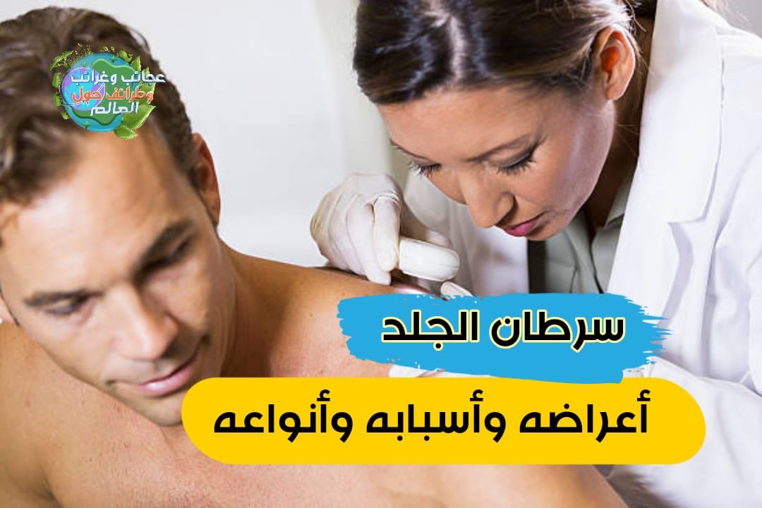 سرطان الجلد*أعراضة وأسبابة وأنواعة* , ظهور حبة تحت الجلد في الثدي عند الرجال , الفرق بين سرطان الجلد والحساسية , كريم لعلاج سرطان الجلد , سرطان الجلد الحميد بالصور , اعراض سرطان الجلد , أعراض سرطان الجلد , سرطان الجلد اعراض , هل سرطان الجلد يسبب حكة , هل سرطان الجلد يسبب حكه , سرطان الجلد , علاج سرطان الجلد بزيت الزيتون , علاج سرطان الجلد , شكل الطفح الجلدي لسرطان الثدي , ما هو سرطان الجلد , ما هو علاج سرطان الجلد , اسباب سرطان الجلد , هل سرطان الجلد قاتل , سرطان الجلد بالصور , سرطان الجلد الحرشفي بالصور , كم يعيش مريض سرطان الجلد , حكة سرطان الجلد , علامات سرطان الجلد , شكل سرطان الجلد , سرطان الخلايا القاعدية , اعراض سرطان الجلد بالصور الميلانوما , هل سرطان الجلد مميت , سرطان الجلد الخبيث بالصور , شكل الزوائد الجلدية السرطانية , سرطان الوجه , نسبة الشفاء من سرطان الجلد الميلانوما الحميدة , هل سرطان الجلد معدي , أعراض سرطان الجلد الميلانوما , سرطان جلد , سرطان الجلد القاعدي بالصور , كم يعيش مريض الميلانوما , صور سرطان الجلد الورم الميلانيني , هل سرطان الجلد خطير , انواع سرطان الجلد , شكل الطفح الجلدي لسرطان الثدي بالصور , اشكال سرطان الجلد , بقع حمراء سرطان الدم , ماهي اعراض سرطان الجلد , أعراض السرطان الجلد ميلانوما الجلد , سرطان الميلانوما , صور لسرطان الجلد , مراحل سرطان الميلانوما , الخلايا القاعدية , أعراض سرطان الظفر , سرطان الجلد الحرشفي , سرطان الجلد الميلانوما , أعراض سرطان الجلد الميلانوما في الأظافر , سرطان الجلد عند الاطفال , ورم ميلانيني , اعراض سرطان الجلد المبكرة , علاج سرطان الجلد بالاعشاب , سرطان الجلد في المناطق الحساسة , عوارض سرطان الجلد , سرطان الجلد الحميد الميلانوما في الظفر , اعراض سرطان الجلد المبكر , بداية سرطان الجلد , ما اعراض سرطان الجلد كانسر الجلد , مرض سرطان الجلد , شكل سرطان الجلد بالصور , ميلانوما الاظافر , أعراض سرطان الجلد في الأظافر , هل سرطان الجلد مؤلم , اعراض مرض سرطان الجلد , كيف يكون سرطان الجلد , أعراض سرطان الجلد عند الأطفال , سرطان الخلايا الصبغية , شكل الحبوب السرطانية , اعراض الميلانوما , جلد البرتقال في الثدي , سرطان الميلانوما في الأظافر , سرطان الظفر , علاج سرطان الجلد بالعسل , سرطان الجلد القاعدي , اعراض سرطان الجلد الميلانوما , سرطان الخلايا الحرشفيه , بقع سرطان الجلد , سرطان حرشفية الخلايا , ورم جلدي , انواع سرطان الجلد بالصور , سرطان الجلد ويكيبيديا , أعراض سرطان الجلد على الأظافر , سرطان الجلد في الوجه , مراحل سرطان الجلد , الجلد الحرشفي , حبوب سرطان الجلد , ما هي علامات سرطان الجلد , اعراض كانسر الجلد , اعراض سرطان الدم على الجلد , أعراض سرطان الجلد , سرطان فروة الراس , اعراض سرطان الخلايا الحرشفية , علاج سرطان الجلد الميلانوما بالصور , شكل سرطان الجلد , أعراض سرطان , سرطان الجلد , علامات السرطان على الجلد , ما هو سرطان الخلايا الحرشفية , اعراض سرطان الميلانوما , سرطان جلدي , الاورام الجلدية , الحبوب السرطانية , أورام الجلد بالصور , خطورة سرطان الجلد , هل السرطان يسبب الحكة , اعراض سرطان الجلد للاطفال , معلومات عن سرطان الجلد , اعراض سرطان الخلايا القاعدية , مرض الميلانوما , علاج سرطان الخلايا الحرشفية , اورام الجلد الحميدة , سبب سرطان الجلد , اعراض سرطان الجلد الحرشفي , علاج الميلانوما , علامات سرطان الجلد بالصور , هل سرطان الميلانوما قاتل , تشخيص سرطان الجلد , سرطان الجلد الخبيث , انواع الشامات الحميدة , ميلانوما الظفر , سرطان جلد الرأس , اشكال الحبوب السرطانية , سرطان البشرة , كيف يبدأ سرطان الجلد , الميلانوما العقدية , اشكال سرطان الجلد بالصور , سرطان الجلد هل هو خطير , الميلانوما الجلدية , سرطان الجلد , علاج سرطان تحت الجلد , ظهور اورام في الجسم , بقع السرطان , صور عن سرطان الجلد , ما هو سرطان الجلد بالصور , ما هو سرطان الجلد وما هي اعراضه , علامات سرطان الجلد المبكرة , سرطان الجلد بالانجليزي , كيف يكون شكل سرطان الجلد , اعراض سرطان الجلد في القدم , قصتي مع سرطان الجلد , مدة تطور سرطان الجلد , ما هو شكل سرطان الجلد , تعريف سرطان الجلد , اعراض سرطان الجلد عند النساء , سرطان الجلد الابيض , مرض ميلانوما , ما هي عوارض سرطان الجلد , الوقاية من سرطان الجلد , الفرق بين الشامه وسرطان الجلد ساركوما , كابوزي الجلد , ما هي الميلانوما , اعراض الاصابة بسرطان الجلد , اعراض سرطان الجلد الحميد , سرطان الجلد ميلانوما , اعراض الورم الميلانيني , سرطان جلد الوجه , اعراض اللوكيميا على الجلد , تحليل سرطان الجلد , سرطان الخلايا القاعديه , هل الطفح الجلدي من اعراض السرطان , اعراض السرطان على الجلد , سرطان الجلد في فروة الراس , اعراض سرطان الجلد في الوجه , سرطان الجلد الميلانيني , سرطان الخلايا الحرشفية في الجلد , شكل حبوب سرطان الجلد , كيف شكل سرطان الجلد , سرطان الجلد الاسود , علاج الميلانوما بالاعشاب , اعراض مرض السرطان الجلد , الورم الجلدي , سرطان الميلانوما بالصور , سرطان الجلد الفطري , شكل سرطان الخلايا القاعدية , الاورام السرطانية تحت الجلد , ماهي اعراض سرطان الجلد بالصور , اثار سرطان الجلد , هل يوجد علاج لسرطان الجلد , سرطان الجلد الميلاني , انواع الشامات الخطيرة , هل سرطان الجلد يظهر في تحليل الدم , مسببات سرطان الجلد , اشكال السرطان الجلدي , اعراض سرطان الدم الجلدي , اشكال البقع السرطانيه , اعراض ميلانوما الاظافر , شكل بقع سرطان الجلد , اعراض سرطان جلد الراس , الاشعة التي تسبب سرطان الجلد , سرطان الجلد للاطفال , سرطان الشامات , حكه الجسم بسبب السرطان , اعراض سرطان البشرة , علاج سرطان الجلد بزيت الزيتون , هل سرطان الجلد قاتل , كريم لعلاج سرطان الجلد , سرطان الجلد الحميد بالصور , علاج سرطان الجلد بالاعشاب , سرطان الجلد الحرشفي بالصور , حكة سرطان الجلد , سرطان الجلد بالصور , هل سرطان الجلد مميت , سرطان الجلد الحميد بالصور , هل سرطان الجلد يسبب حكة , سرطان الجلد الخبيث بالصور , حكة سرطان الجلد , علاج سرطان الجلد , سرطان الجلد الحرشفي بالصور , سرطان الجلد القاعدي بالصور , سرطان الجلد,اعراض السرطان,اعراض مرض السرطان,سرطان الدم,سرطان الجلد اعراضه,سرطان الجلد الميلانوما,أعراض مرض السرطان,سرطان الجلد القاعدي,سرطان,اعراض سرطان الجلد الميلانوما,سرطان الجلد الحميد,السرطان,علامات السرطان,أعراض سرطان الثدي,مرض السرطان,أعراض سرطان الجلد عند الأطفال,سرطان الجلد واعراضه,سرطان الثدي,أعراض سرطان الجلد,ماهي اعراض سرطان الجلد,اعراض سرطان الجلد,اعراض سرطان الجلد على اليدين,اعراض سرطان الجلد عند النساء,أعراض السرطان,سرطان الجلد,سرطان الخلايا الحرشفية في الرئة,سرطان الجلد الحرشفي,اعراض سرطان الجلد,سرطان الخلايا القاعدية,سرطان الخلايا الحرشفية في الفم,سرطان الخلايا الحرشفية في اللسان,سرطان الخلايا الحرشفية لعنق الرحم,اعراض سرطان الخلايا الصبغية,سرطان,أعراض سرطان الجلد الحرشفي,سرطان الجلد اعراضه,سرطان الخلية الحرشفية,السرطان,سرطان الجلد القاعدي,اعراض السرطان المبكرة,علاج سرطان الخلايا العصبية,اعراض السرطان,مرض السرطان,سرطان الخلايا العصبية,علاج سرطان الجلد,سرطان الخلايا القاعدية,سرطان الجلد,سرطان الخلايا الحرشفية في الرئة,سرطان الجلد القاعدي,سرطان الخلية القاعدية,سرطان الخلايا القاعديّة الكيسي:,سرطان الخلايا القاعديّة السّطحي,سرطان الخلايا القاعديّة النّدبي أ,سرطان الخلايا القاعديّة الإرتشاحي,سرطان الخلايا القاعديّة المُصطبغ:,سرطان,سرطان الدم,علاج سرطان الجلد,سرطان الخلايا العصبية,ارتفاع الخلايا القاعدية,اعراض سرطان الخلايا الصبغية,علاج سرطان الخلايا العصبية,الخلايا القاعدية basophils,اعراض سرطان الجلد, سرطان الجلد,سرطان الجلد الحرشفي,سرطان الجلد القاعدي,علاج سرطان الجلد,سرطان الجلد بالصور,سرطان الجلد اعراضه,سرطان الخلايا الحرشفية في الرئة,سرطان الجلد الحميد,سرطان الخلايا القاعدية,سرطان الجلد الميلانيني,صور سرطان الجلد,شكل سرطان الجلد,اعراض سرطان الجلد,هل سرطان الجلد قاتل,سرطان,سرطان الجلد عند الاطفال,هل سرطان الجلد معدي,ما هو سرطان الجلد,انواع سرطان الجلد,هل سرطان الجلد مؤلم,اعراض سرطان الجلد الميلانوما,سرطان الدم,سرطان الخلايا الحرشفية في الفم, وفاء الكيلاني,الورم السرطاني,الورم الحميد,الوزن الزائد,الماني,أول ظهور لوفاء الكيلاني,تخفيف الوزن,تخسيس الوزن,اعراض سرطان الجلد الميلانيني,السيلان,وفاء الكيلاني السيرة,ظهور وفاء الكيلاني بعد الطلاق,وفاء الكيلاني تنهار من البكاء,السيرة مع وفاء الكيلاني,وفاء الكيلاني dmc,الأورام الحميدة,بكاء وفاء الكيلاني,وفاء الكيلاني تبكي,وفاء الكيلاني واحمد السقا,وفاء الكيلانى وتيم الحسن,فضيحة وفاء الكيلاني,انهيار وفاء الكيلاني,برنامج وفاء الكيلاني, سرطان الجلد,سرطان الجلد بالصور,سرطان الجلد اعراضه,سرطان الجلد القاعدي,صور سرطان الجلد,علاج سرطان الجلد,اعراض سرطان الجلد,اسباب سرطان الجلد,سرطان الجلد الحميد,سرطان الجلد الحرشفي,سرطان الجلد عند الاطفال,سرطان الجلد الميلانوما,ما هو سرطان الجلد,هل سرطان الجلد معدي,سرطان الجلد في اليد,سرطان,شكل سرطان الجلد,هل سرطان الجلد قاتل,هل سرطان الجلد مميت,سرطان الجلد وعلاجه,كيف يبدأ سرطان الجلد,اعراض سرطان الجلد بالصور,السرطان,انواع سرطان الجلد,سرطان الدم ,سرطان الجلد,سرطان الجلد بالصور,علاج سرطان الجلد,سرطان الجلد اعراضه,سرطان الجلد القاعدي,سرطان الجلد عند الاطفال,صور سرطان الجلد,ما هو سرطان الجلد,سرطان الجلد الحرشفي,اعراض سرطان الجلد,هل سرطان الجلد معدي,سرطان الجلد في اليد,سرطان الجلد الميلانوما,سرطان,سرطان الجلد وعلاجه,شكل سرطان الجلد,هل سرطان الجلد قاتل,سرطان الجلد الحميد,هل سرطان الجلد مميت,اعراض سرطان الجلد بالصور,سرطان الجلد عند الاطفال بالصور,علاج,سرطان الدم,سرطان الجلد اعراض,سرطان الجلد,سرطان الجلد بالصور,سرطان الجلد اعراضه,سرطان الجلد القاعدي,سرطان الجلد الحرشفي,سرطان الجلد عند الاطفال,اعراض سرطان الجلد,صور سرطان الجلد,علاج سرطان الجلد,سرطان الجلد الميلانوما,سرطان الجلد الحميد,هل سرطان الجلد معدي,انواع سرطان الجلد,سرطان,شكل سرطان الجلد,ما هو سرطان الجلد,هل سرطان الجلد قاتل,هل سرطان الجلد مميت,سرطان الجلد في اليد,السرطان,سرطان الجلد والاظافر,اسباب سرطان الجلد,سرطان الدم,سرطان الجلد وعلاجه,سرطان الجلد الميلانيني , سرطان الجلد,سرطان الجلد اعراضه,سرطان الجلد بالصور,اعراض سرطان الجلد,سرطان الجلد القاعدي,صور سرطان الجلد,اعراض السرطان,سرطان الجلد الحرشفي,سرطان الجلد عند الاطفال,سرطان الجلد الميلانوما,اعراض مرض السرطان,اعراض سرطان الجلد بالصور,علاج سرطان الجلد,هل سرطان الجلد معدي,سرطان,شكل سرطان الجلد,ما هو سرطان الجلد,اسباب سرطان الجلد,هل سرطان الجلد قاتل,سرطان الجلد الحميد,هل سرطان الجلد مميت,سرطان الجلد في اليد,اعراض سرطان الثدى,السرطان ,سرطان الجلد,سرطان الجلد بالصور,سرطان الجلد اعراضه,سرطان الجلد القاعدي,علاج سرطان الجلد,سرطان الجلد الحرشفي,سرطان الجلد عند الاطفال,ما هو سرطان الجلد,سرطان,هل سرطان الجلد معدي,سرطان الجلد في اليد,سرطان الجلد الميلانوما,صور سرطان الجلد,شكل سرطان الجلد,سرطان الجلد اعراض,انواع سرطان الجلد,اعراض سرطان الجلد,هل سرطان الجلد قاتل,هل سرطان الجلد مؤلم,سرطان الجلد الحميد,هل سرطان الجلد مميت,سرطان الجلد وعلاجه,كيف يكون سرطان الجلد,كيف يبدأ سرطان الجلد , سرطان الجلد , سرطان الجلد أعراضه و أسبابه و أنواعه , أعراضه و أسبابه و أنواعه