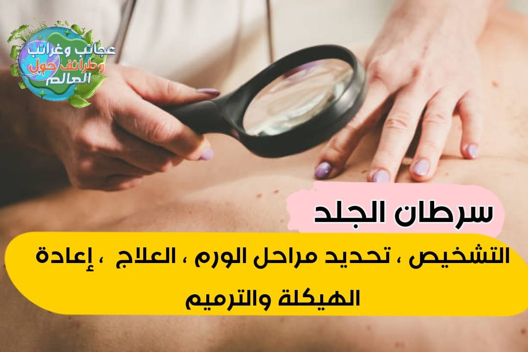 الفرق بين اورام الثدي الحميدة والخبيثة