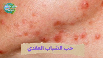 حب الشباب,علاج حب الشباب,التخلص من حب الشباب,علاج حب الشباب للبشرة الدهنية,اسباب حب الشباب,ازالة حب الشباب,حب الشباب في الوجه,اسباب ظهور حب الشباب,حب الشباب وعلاجه,إزالة حب الشباب,معالجة حب الشباب,حب الشباب العقدي,كيف تعالج حب الشباب,حب الشباب الكثير,حب الشباب الكيسي,مشاكل حب الشباب,حب الشباب للبنات,تخلص من حب الشباب,حب الشباب وعلاجه السريع,حب الشباب الهرموني,سبب حب الشباب,مدة حب الشباب,حب الشباب بالانجليزي,أثار حب الشباب