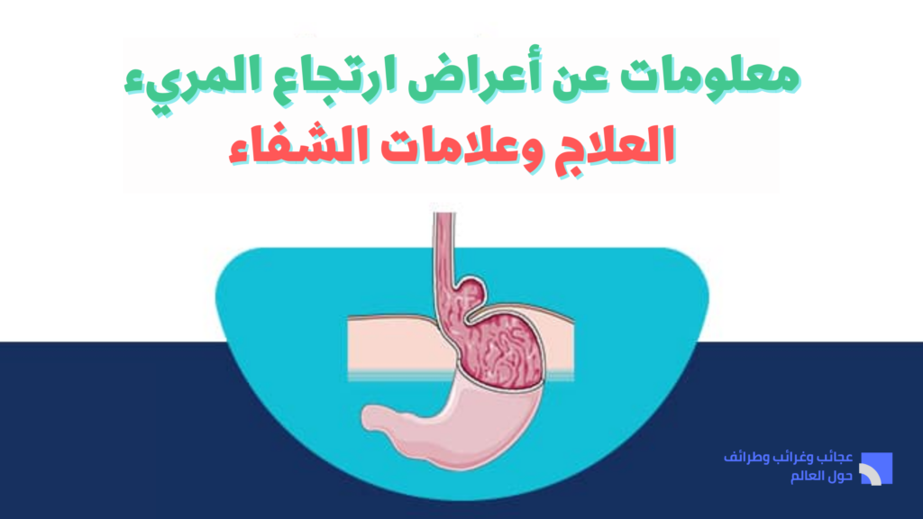 اعراض ارتجاع المريء النفسية