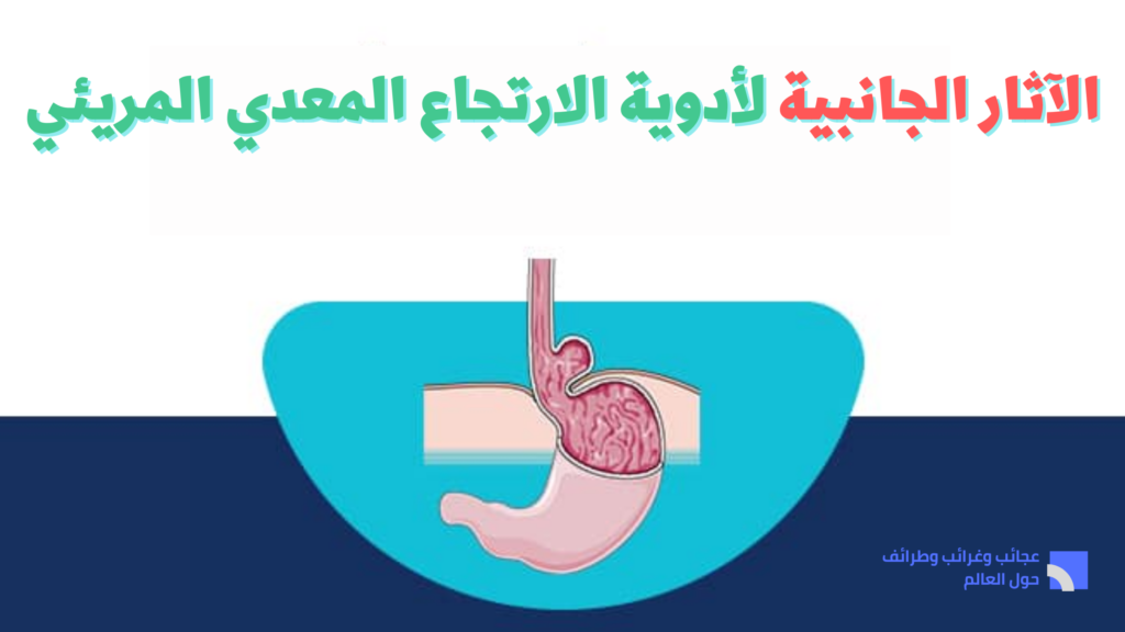 الآثار الجانبية لأدوية الارتجاع المعدي المريئي